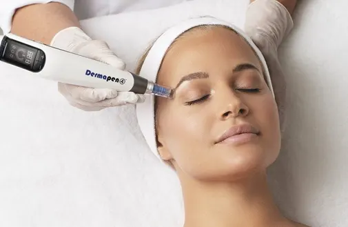 Microneedling